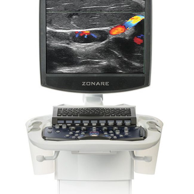 Ультразвуковая система премиум-класса Zonare ZS3