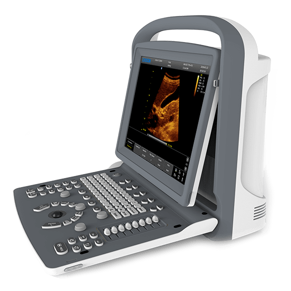 УЗИ аппарат CHISON ECO 2