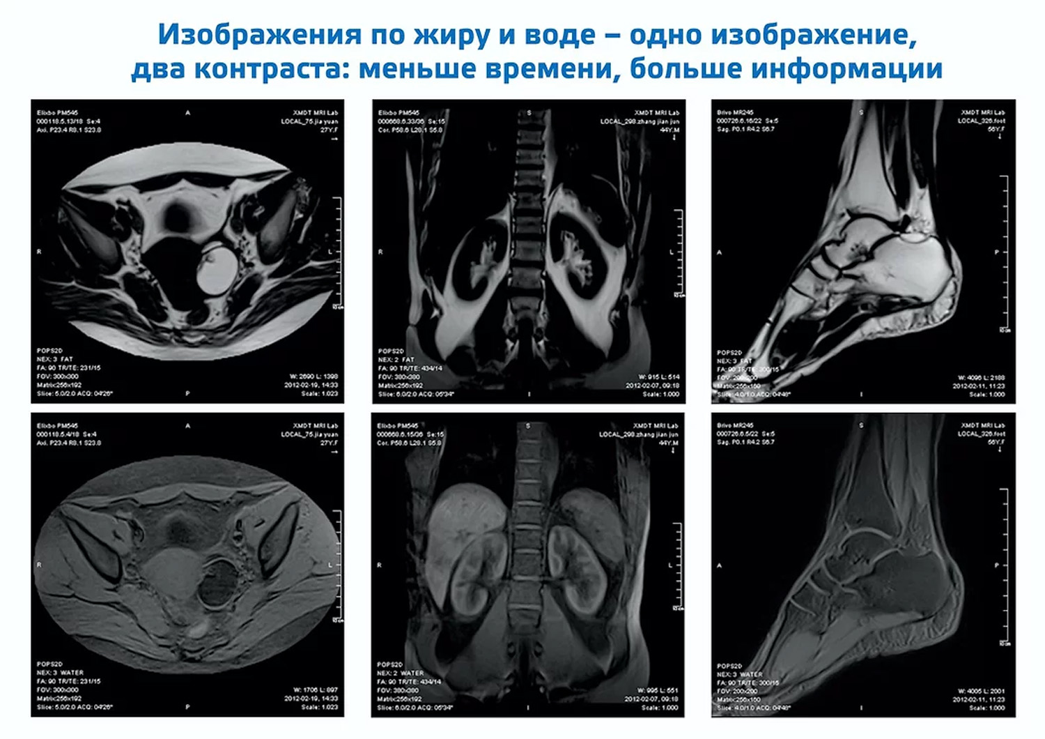 Магнитно-резонансный томограф открытого типа МРТ-АМИКО450