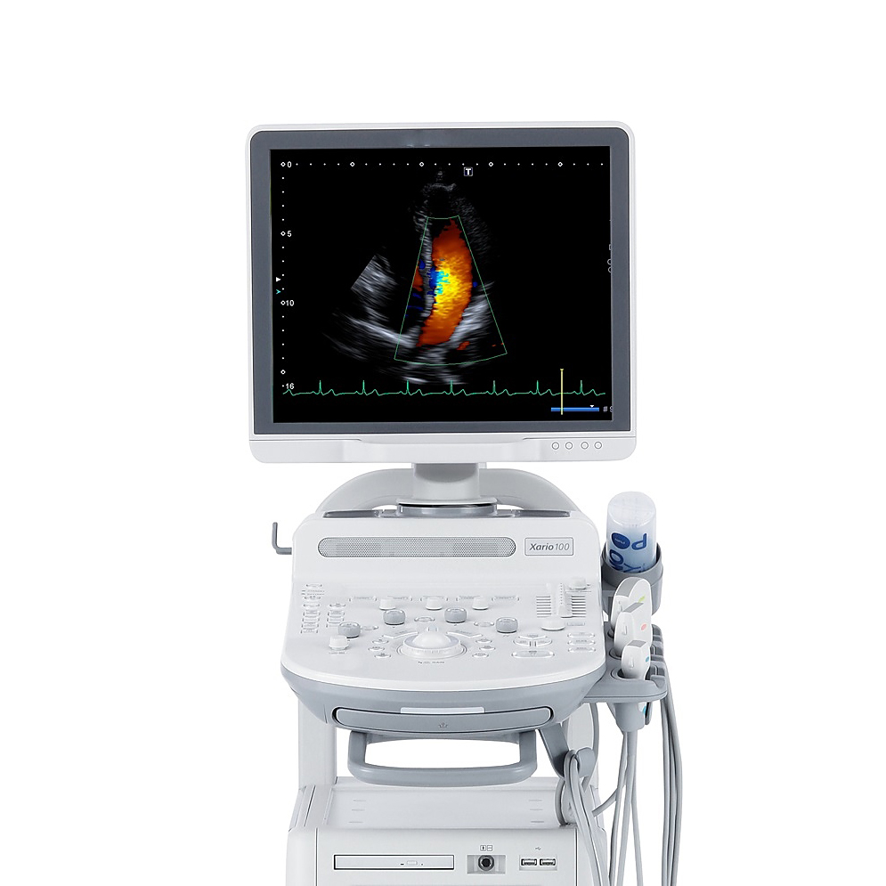Ультразвуковая диагностическая система Canon Xario 100