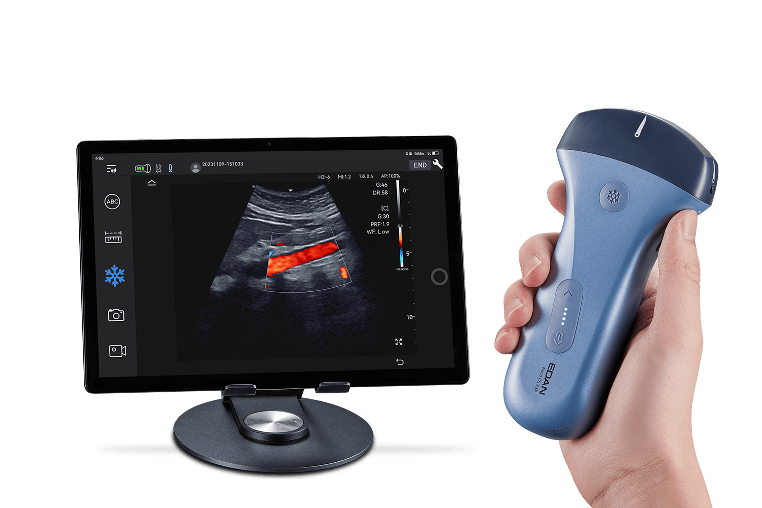 УЗИ аппарат Edan Nano C5 EXP