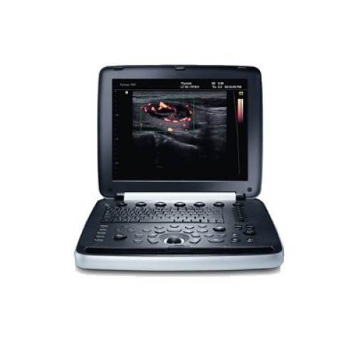 УЗИ аппарат РуСкан 70П