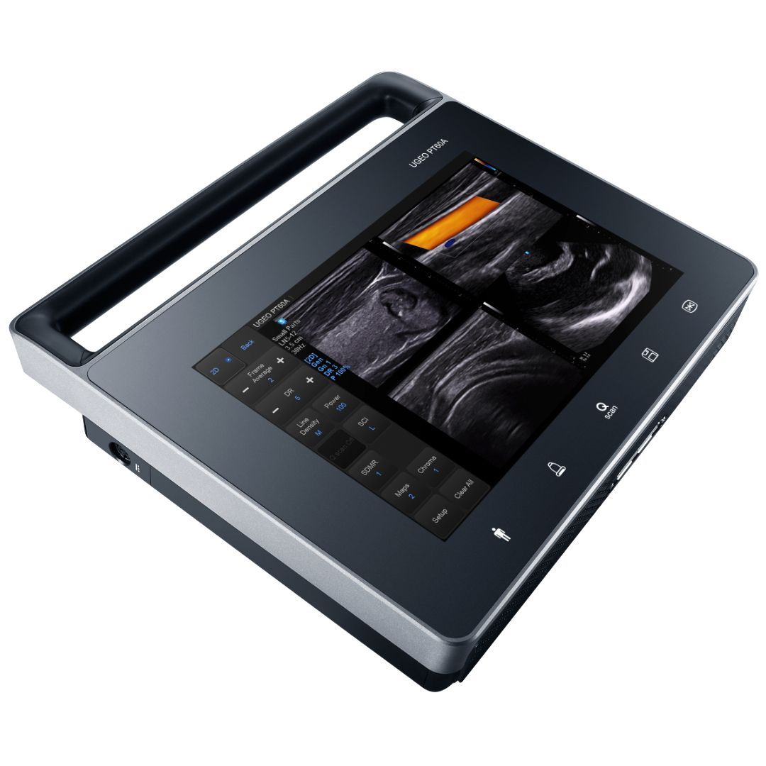 УЗИ аппарат Samsung PT60