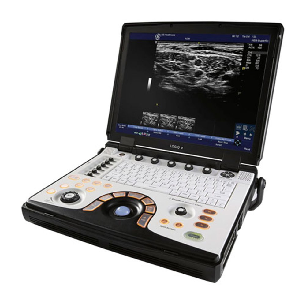 Портативная ультразвуковая система GE Healthcare LOGIQ E
