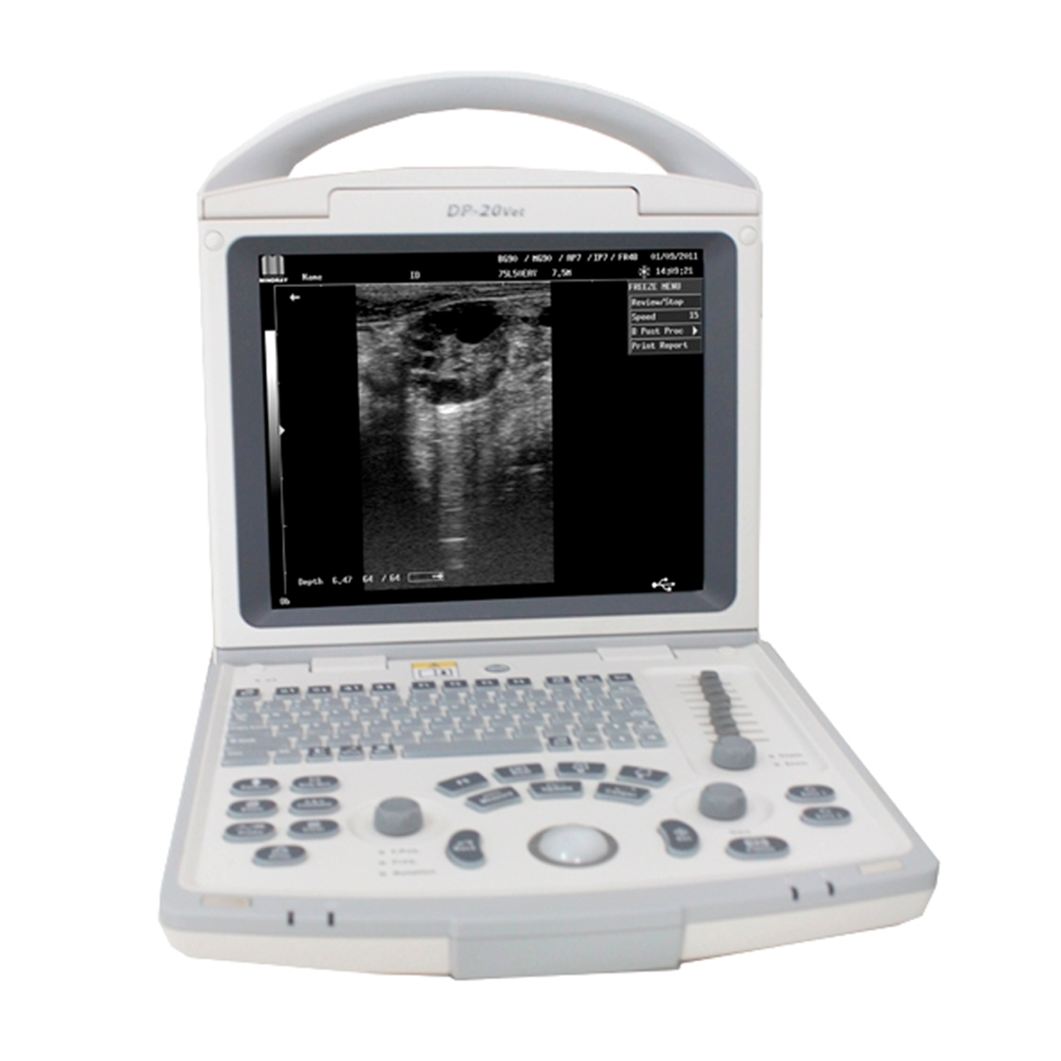УЗИ система Mindray DP-20