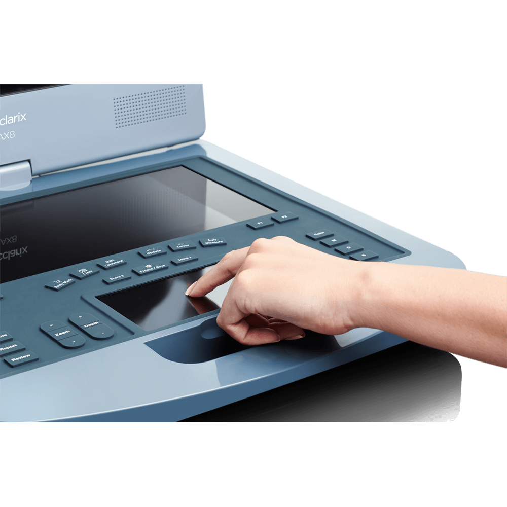 Аппарат УЗИ Edan Acclarix AX8