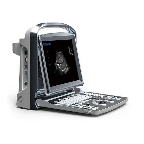 УЗИ аппарат CHISON ECO 1