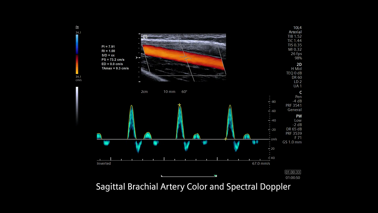 Ультразвуковая система Siemens ACUSON Redwood