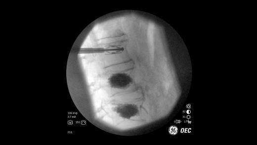 Мобильный рентгеновский аппарат с С-дугой GE OEC One