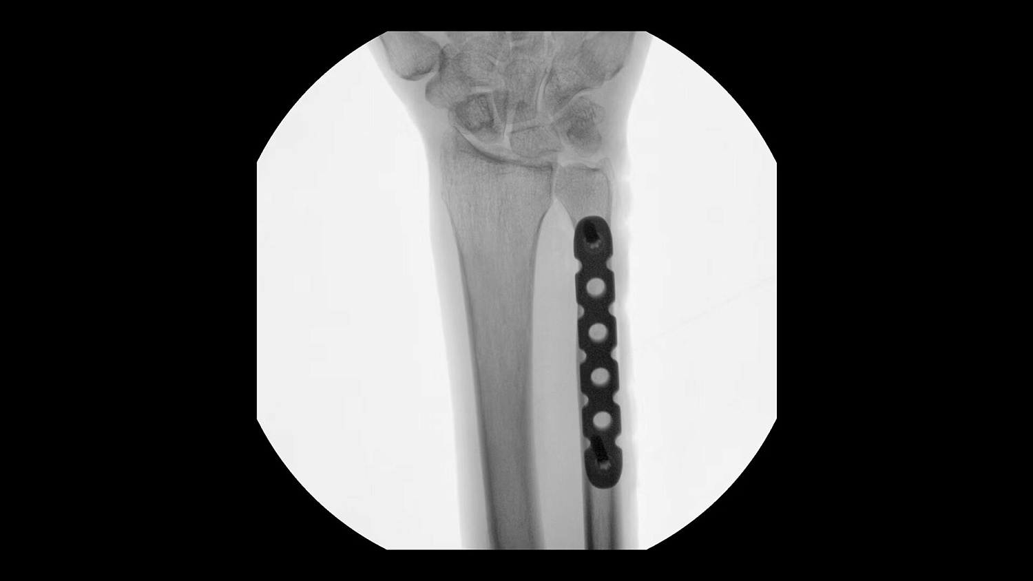 Мобильный рентгеновский аппарат с С-дугой GE OEC Elite MiniView