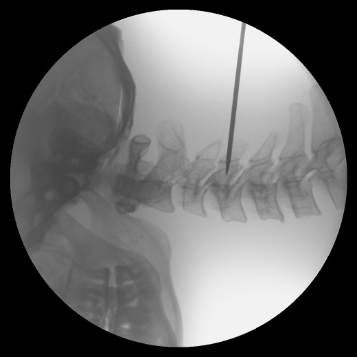 С.П. Гелпик «РЕНЕКС» 5,3 кВт мобильный рентгенохирургический аппарат типа С-дуга с цифровым УРИ