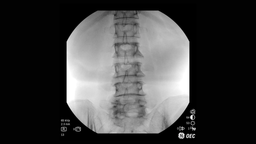 Мобильный рентгеновский аппарат с С-дугой GE OEC One CFD
