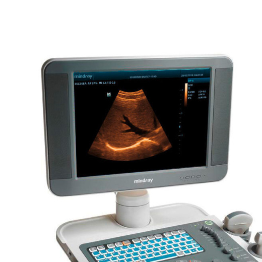 УЗИ аппарат Mindray DP-5