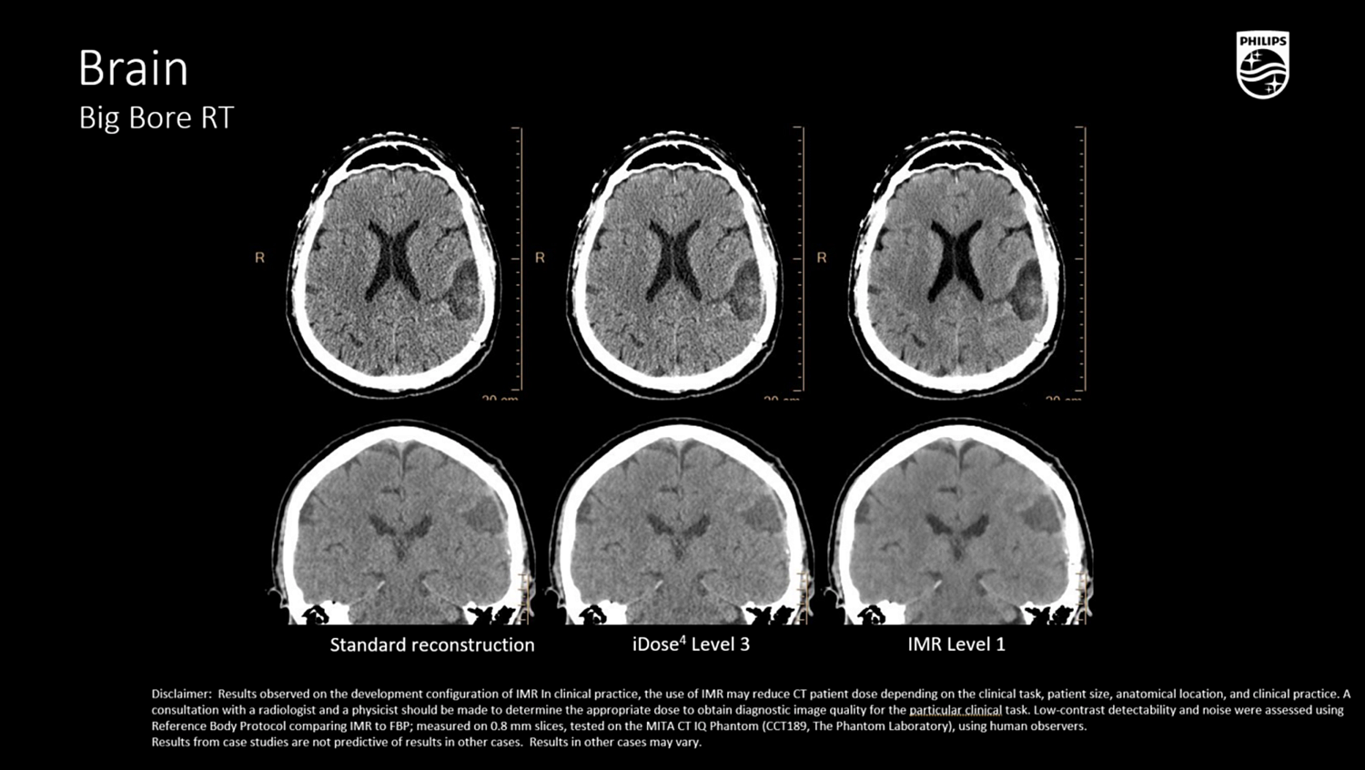 Компьютерный томограф Philips CT Big Bore