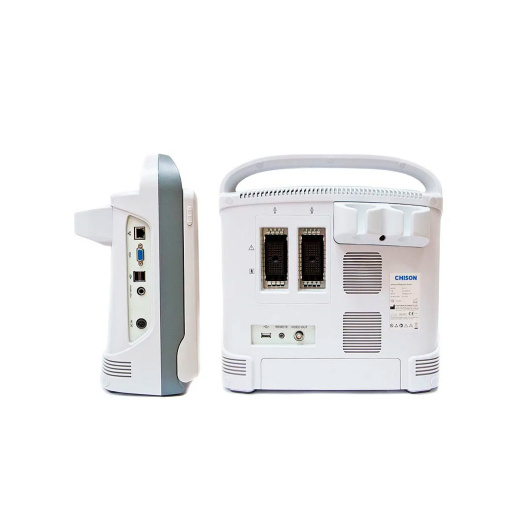 УЗИ аппарат CHISON ECO 1