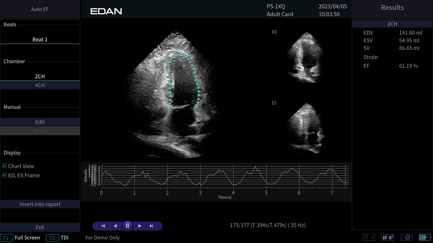 Аппарат УЗИ Edan Acclarix AX8