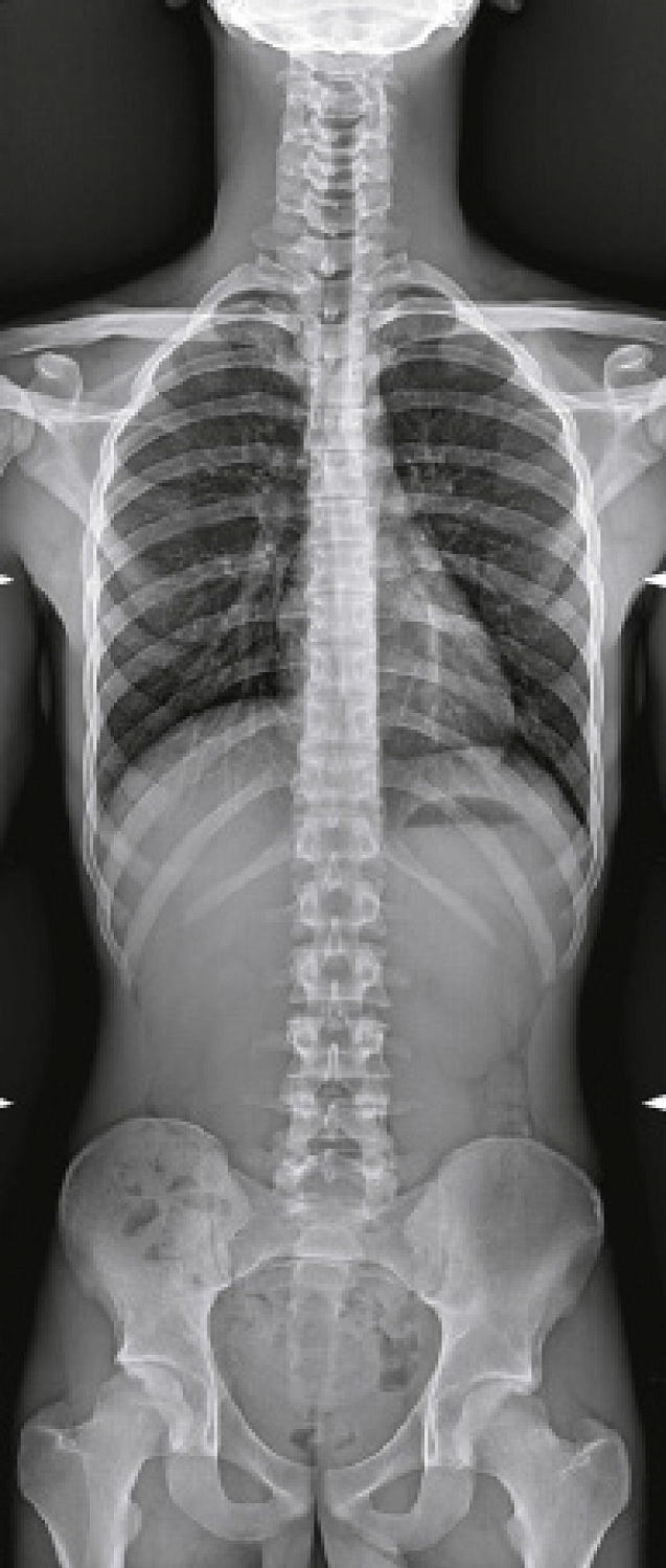 Цифровой рентгеновский комплекс Электрон MIBEL