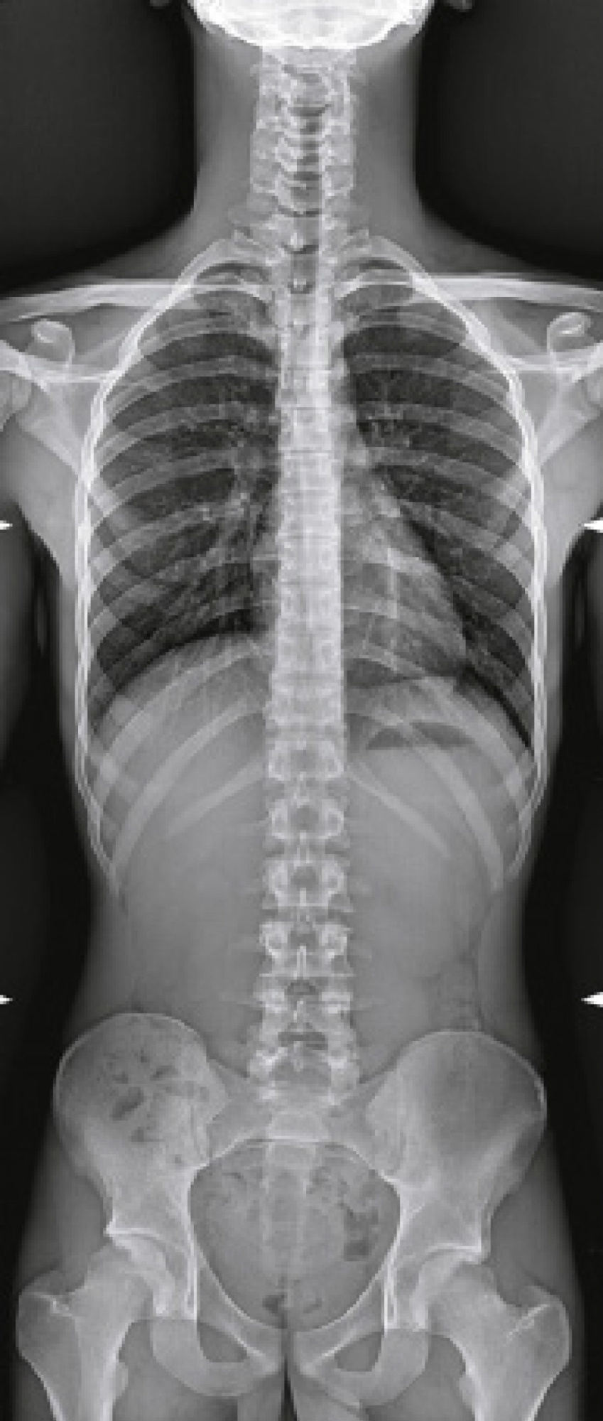 Цифровой рентгеновский комплекс Электрон MIBEL