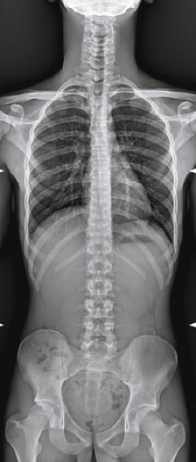 Цифровой рентгеновский комплекс Электрон MIBEL