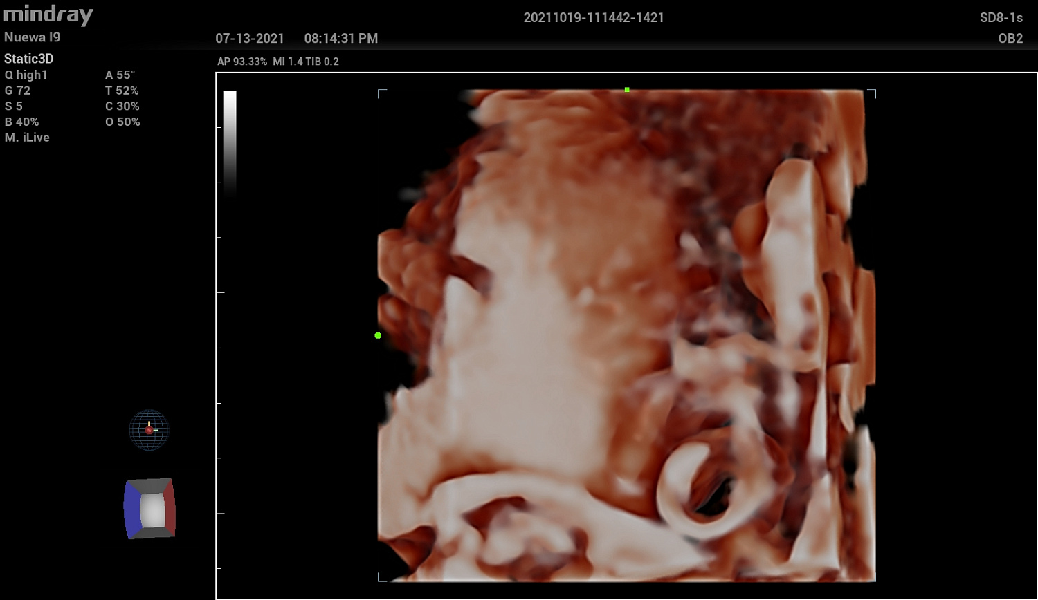 Ультразвуковой аппарат Mindray Imagyn I9