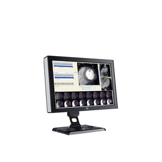 ПО для магнитно-резонансного анализа желудочков Esaote CAAS MRV