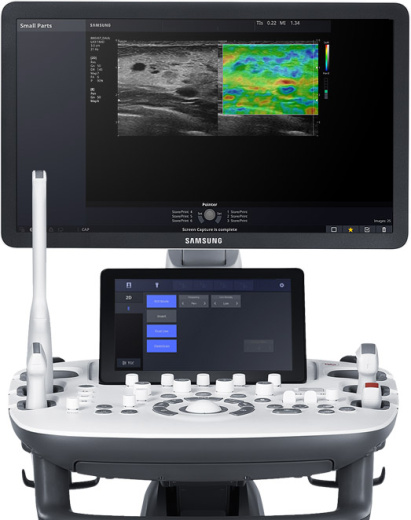 УЗИ аппарат Samsung HS50