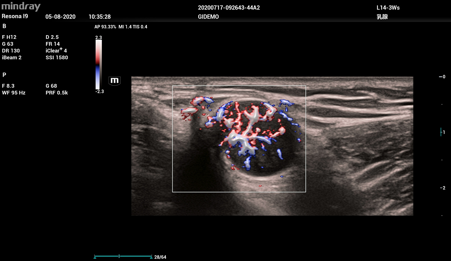 Ультразвуковой аппарат Mindray Resona I9