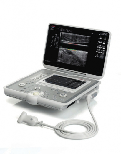 УЗИ аппарат Esaote MyLab Sigma