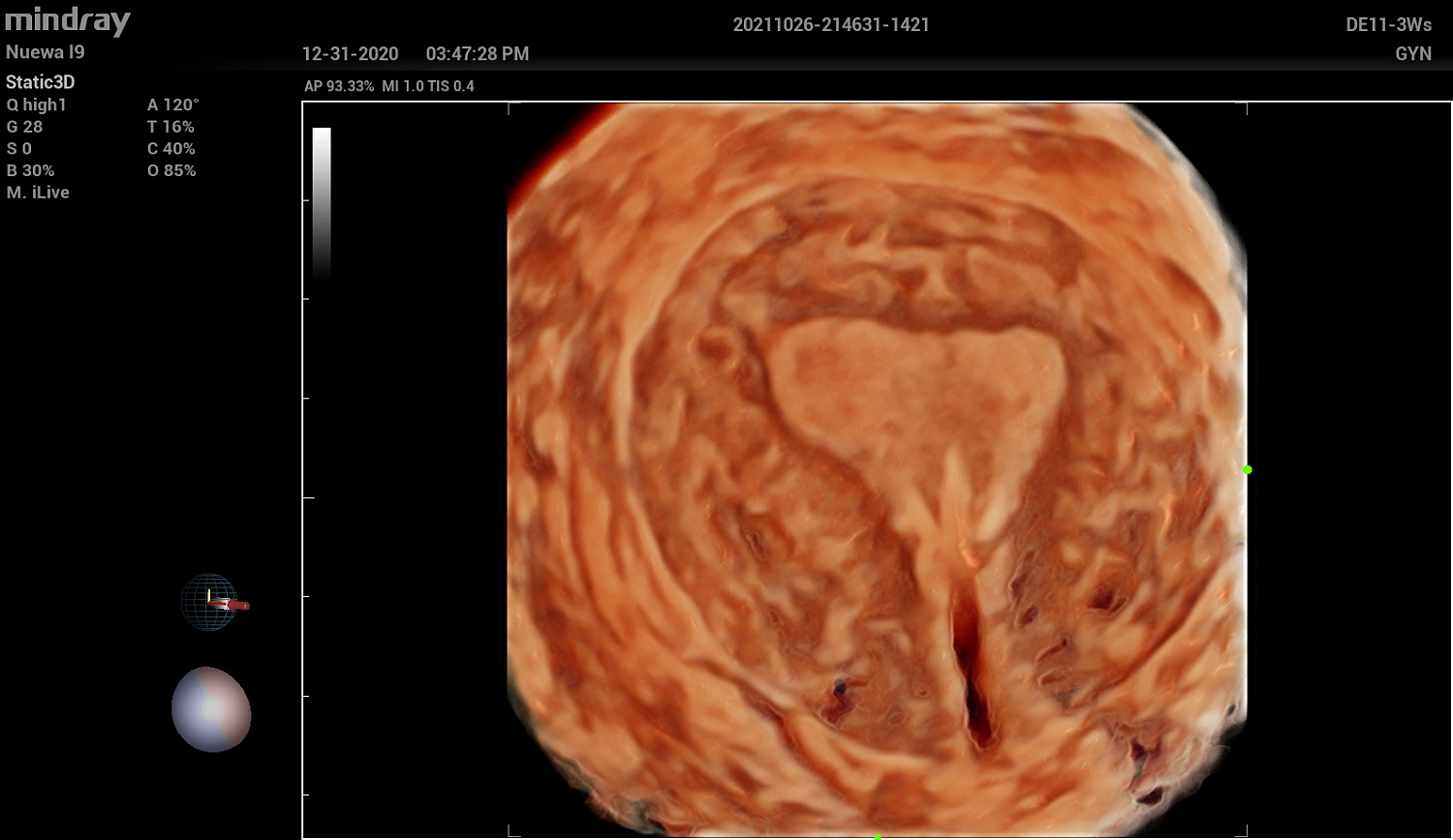 Ультразвуковой аппарат Mindray Imagyn I9