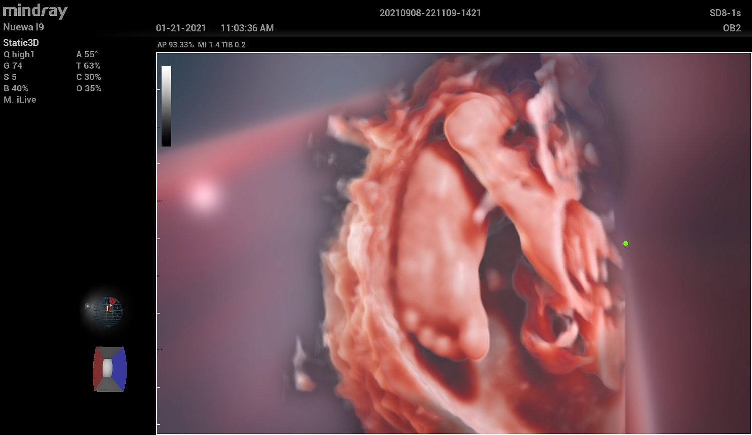 Ультразвуковой аппарат Mindray Imagyn I9