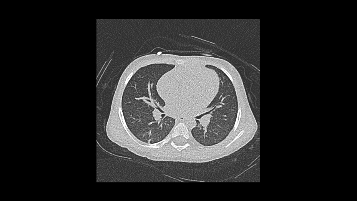 Компьютерный томограф Siemens SOMATOM Force