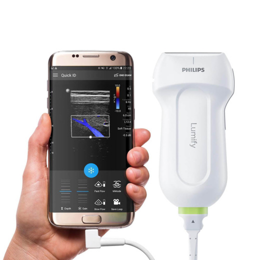 Мобильная ультразвуковая система Philips Lumify