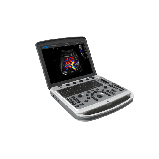 УЗИ аппарат Chison SonoTouch 80 (SonoBook 6)