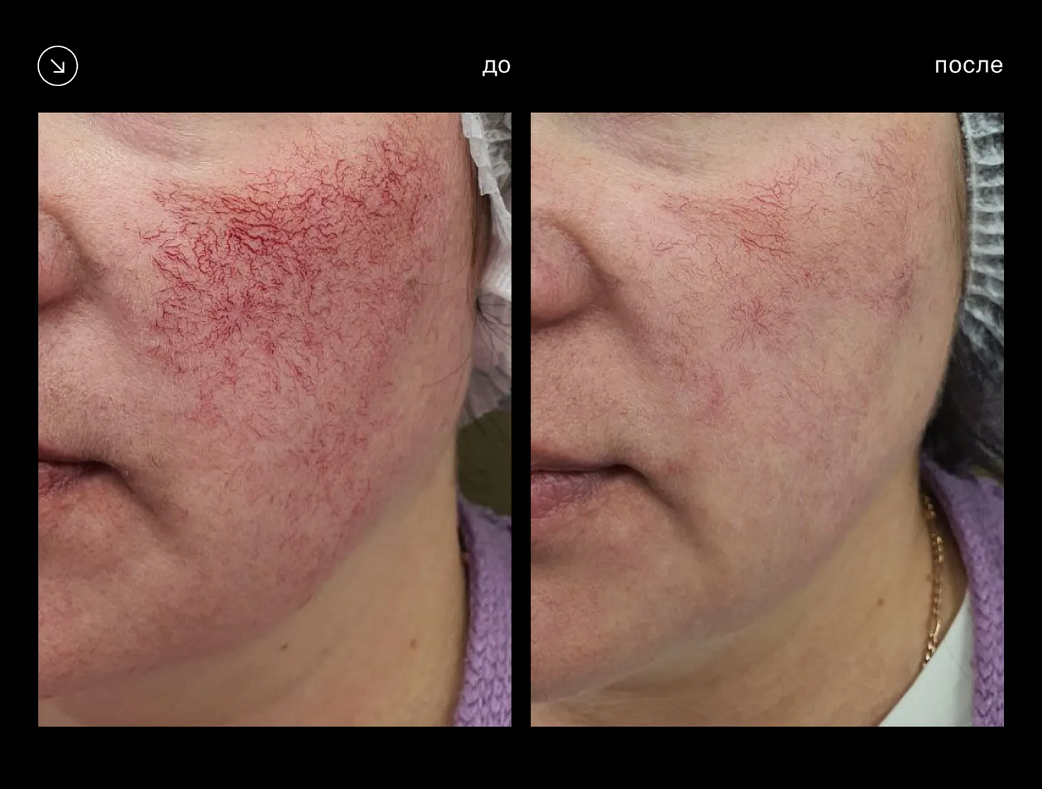 Eunsung Global ClearLight