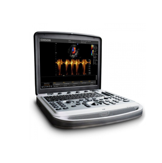 УЗИ аппарат Chison SonoTouch 80 (SonoBook 6)