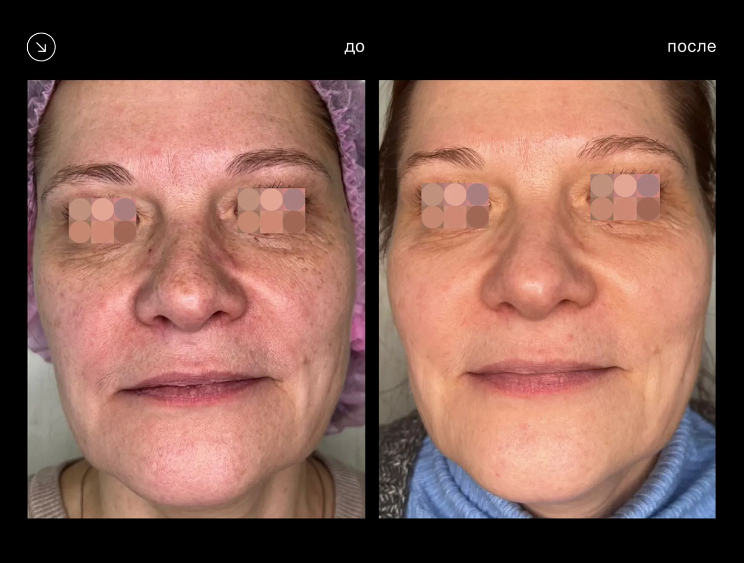 Eunsung Global ClearLight