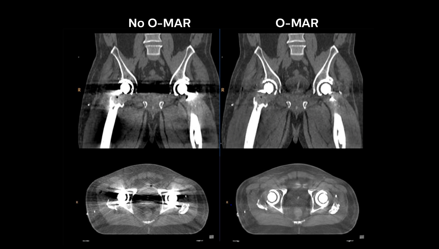 Компьютерный томограф Philips CT Big Bore