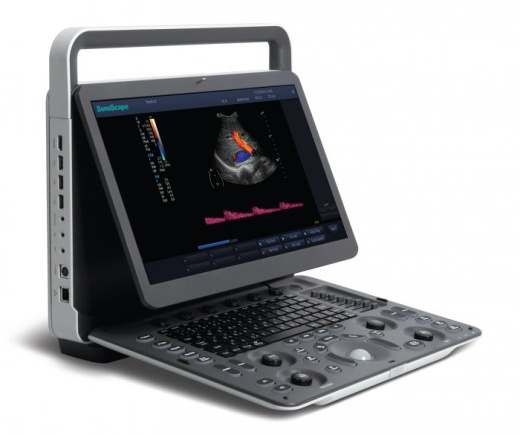 УЗИ аппарат SonoScape E1