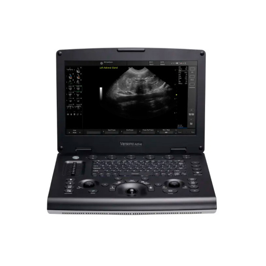 Ультразвуковая система GE Versana Active