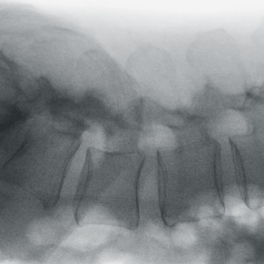 Передвижная рентгеноскопическая система Ziehm Vision RFD 3D