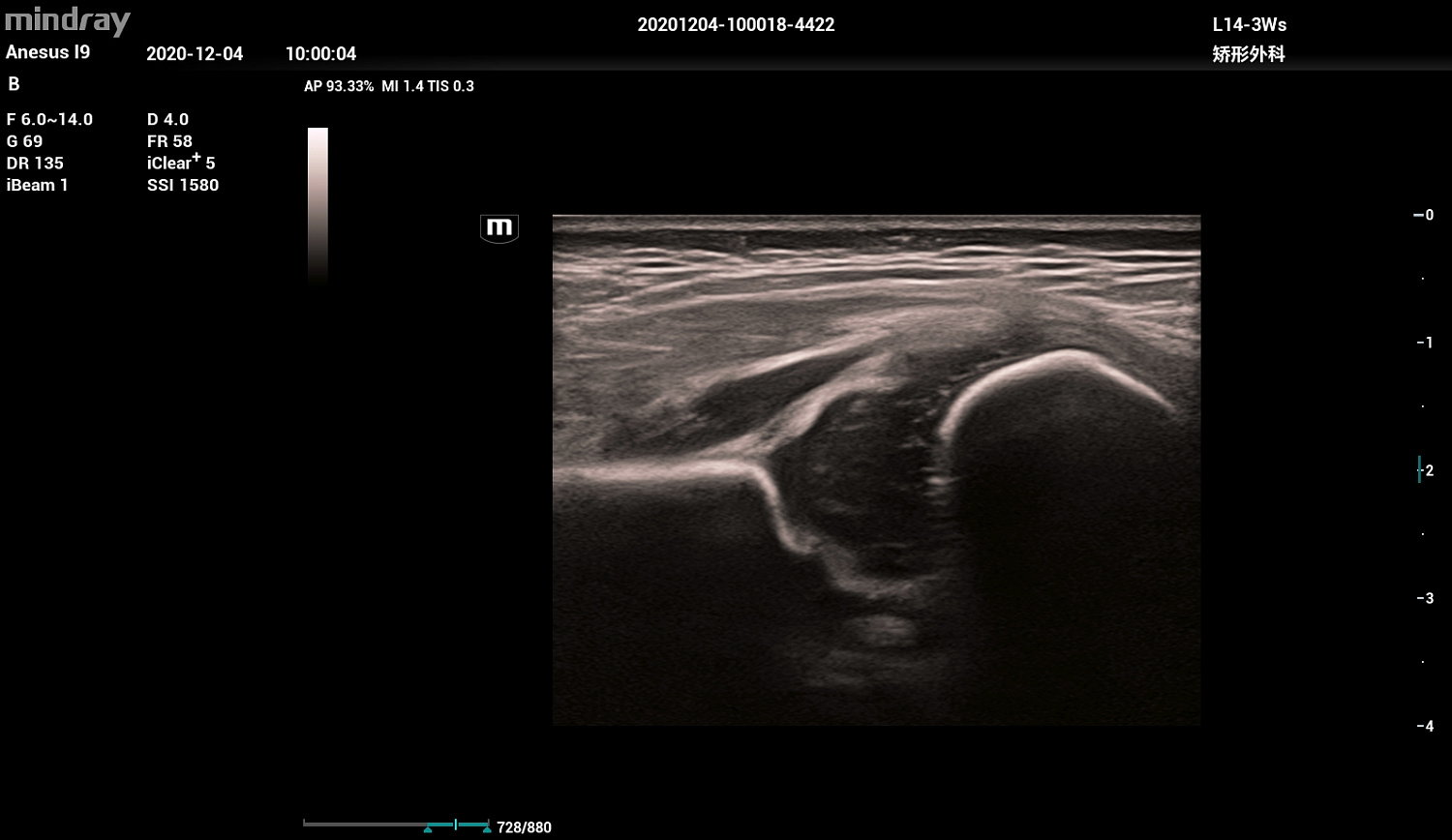 Ультразвуковой аппарат Mindray Resona I9