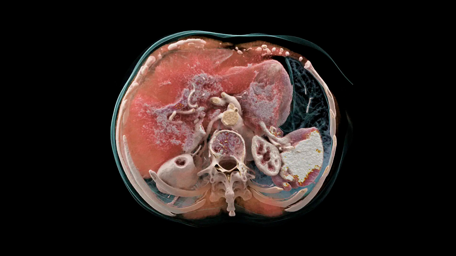 Компьютерный томограф Siemens NAEOTOM Alpha
