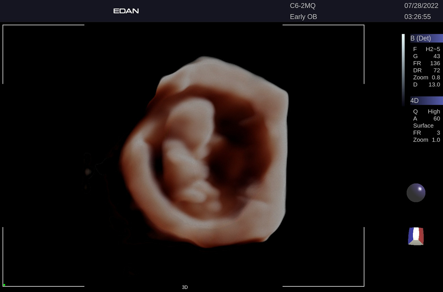 УЗИ аппарат Edan Acclarix LX9