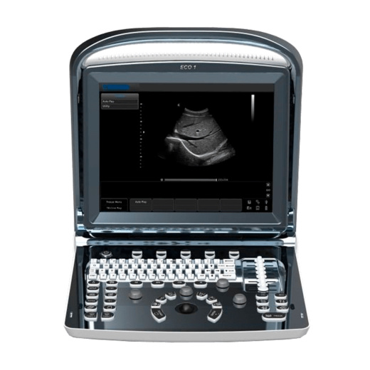 Портативный УЗИ аппарат Chison SonoTouch 10