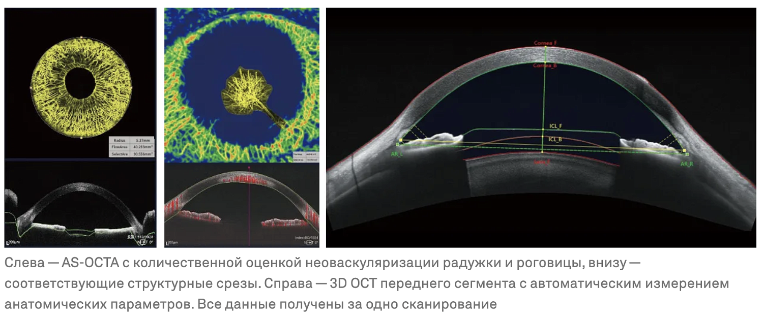 TowardPi BMizar