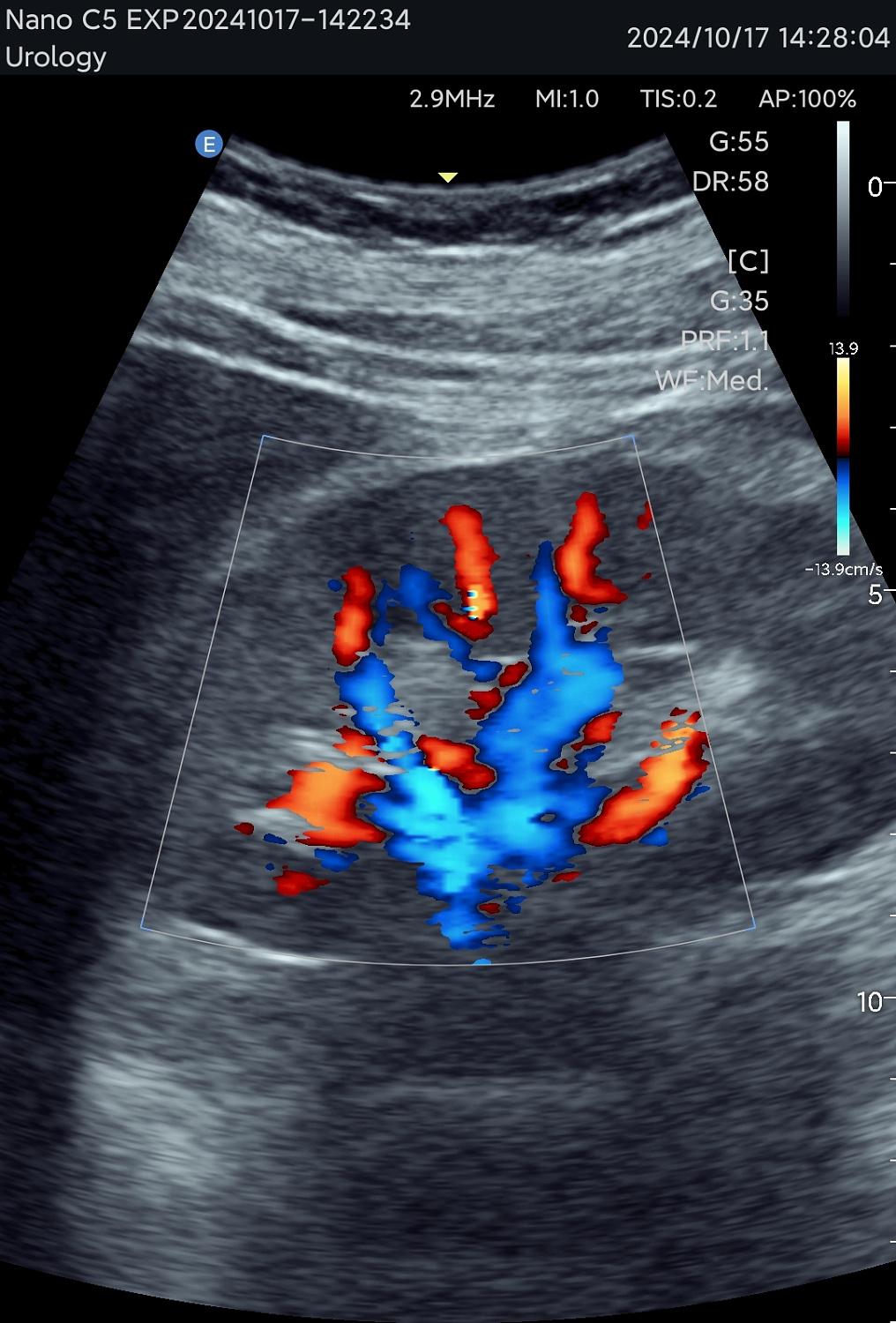 УЗИ аппарат Edan Nano C5 EXP