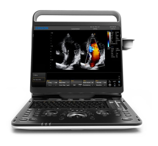 УЗИ аппарат CHISON EBit 60