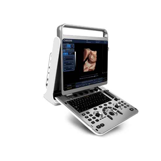 УЗИ аппарат CHISON EBit 30