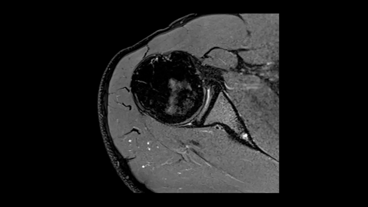 Магнитно-резонансный томограф Siemens MAGNETOM Altea