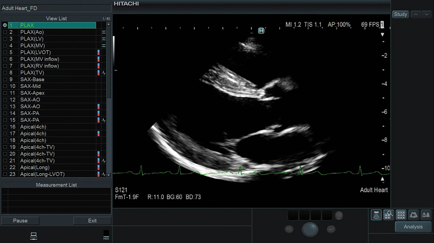 УЗИ аппарат Fujifilm Lisendo 880LE